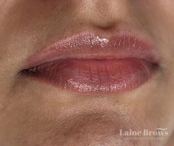 Dark Lip Neutralization