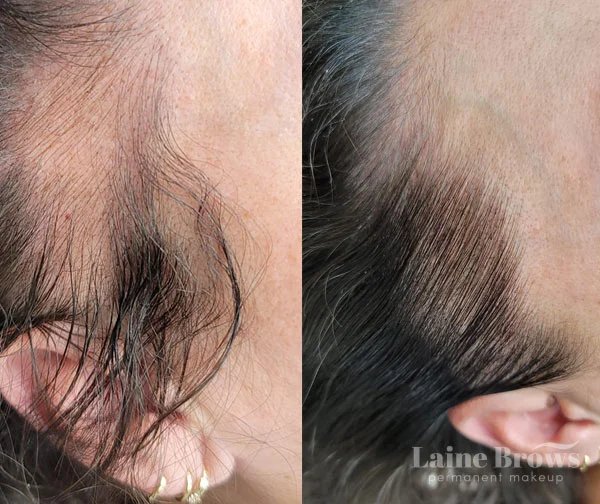 Scalp Micropigmentation (SMP)