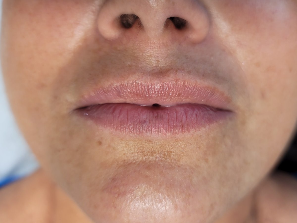 BEFORE & AFTER — Before